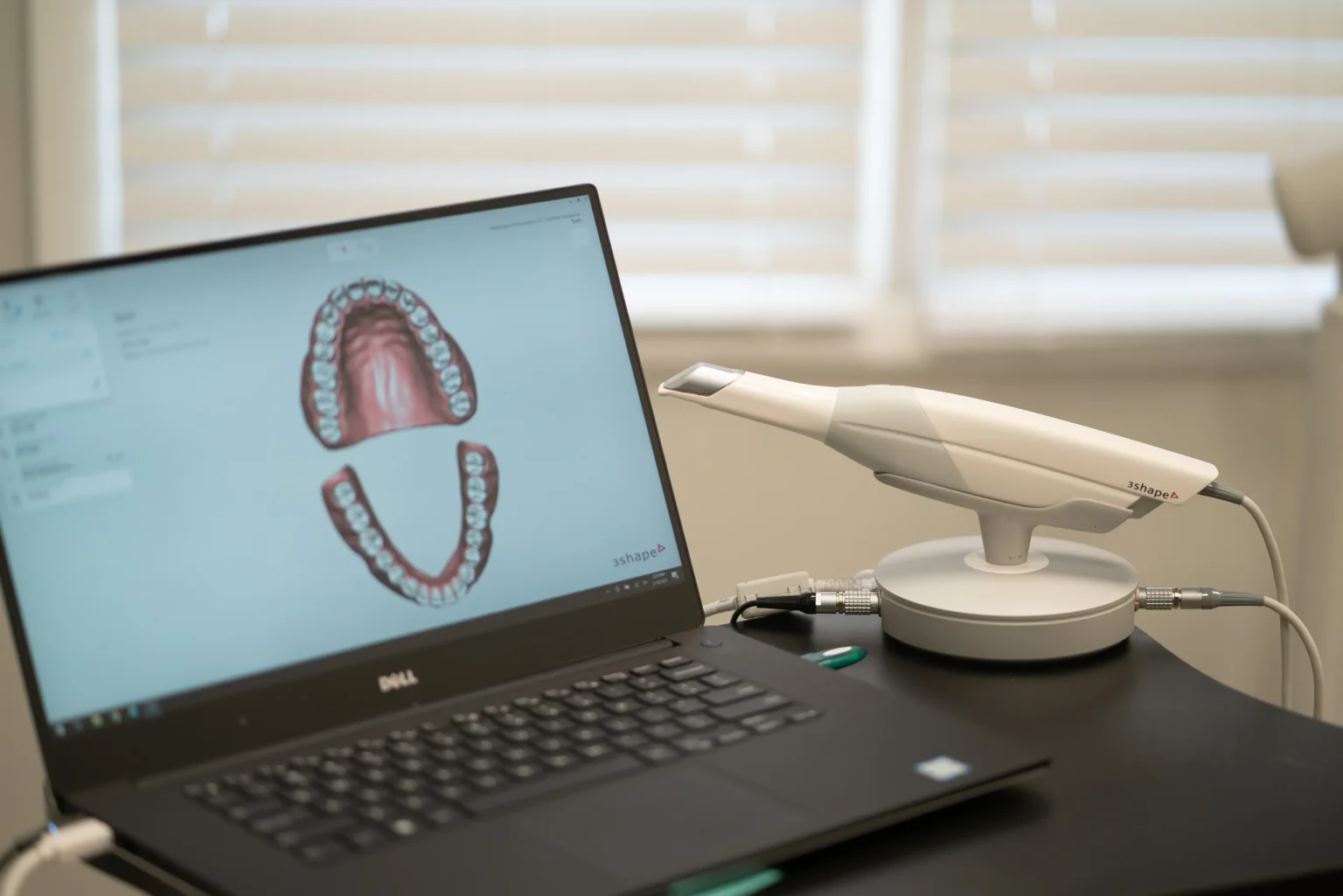Digital Dental Scanner Displaying 3D Oral Imaging Technology